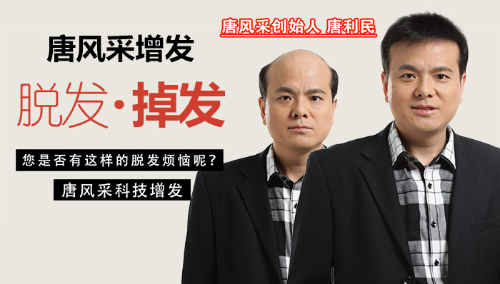 男人婚后為什么易胖易禿？ 除了遺傳，多半原因是它！