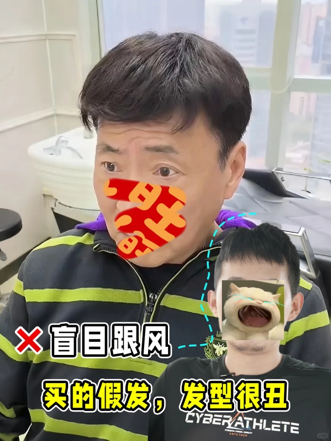 \